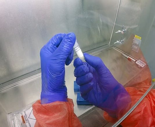 Potrjen še tretji primer koronavirusa v Sloveniji!